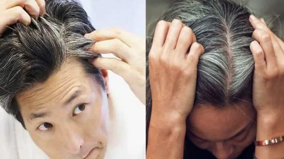 How To Get Rid Of White Hair